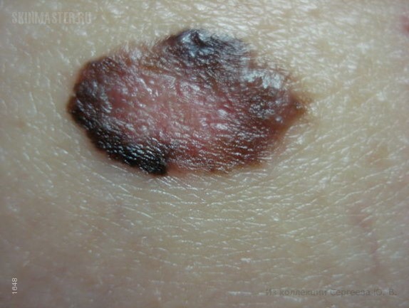 pic5